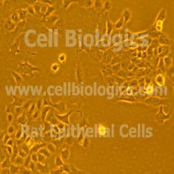 ZDF Rat Diabetic Epithelai Cells (16)